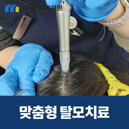 맞춤형 탈모치료