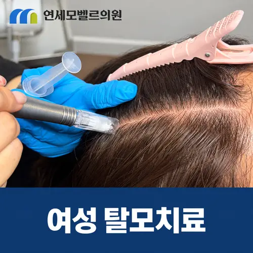 여성 탈모치료