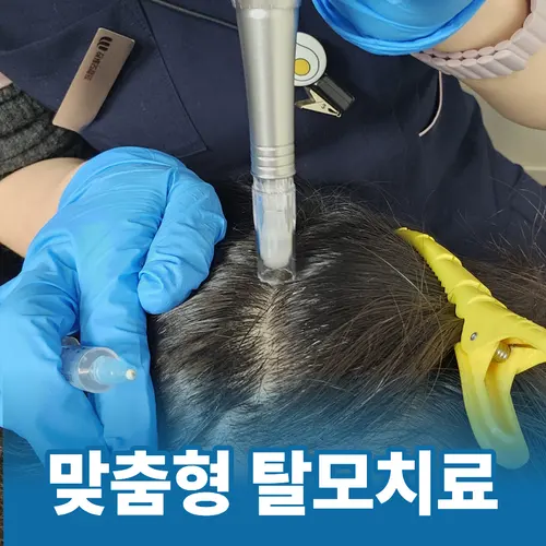 종로5가 탈모병원 맞춤형 두피 치료 장면